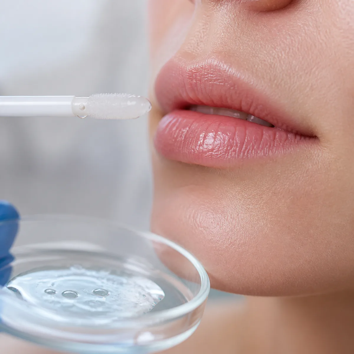 Hydra Gloss Lips na Dra. Greice Trevisani em São Bento do Sul