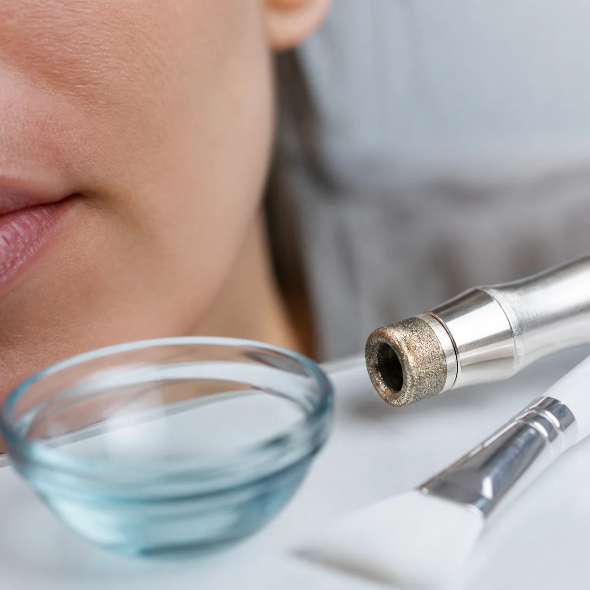 Peeling de diamante e químico na Dra. Greice Trevisani em São Bento do Sul