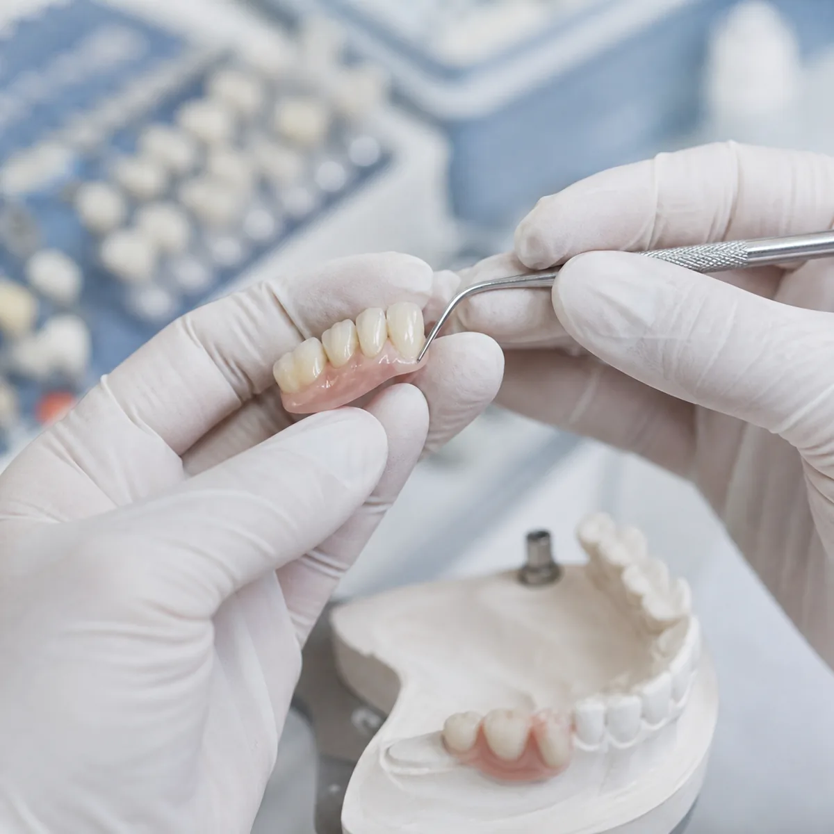 Prótese dentária na Dra. Greice Trevisani em São Bento do Sul
