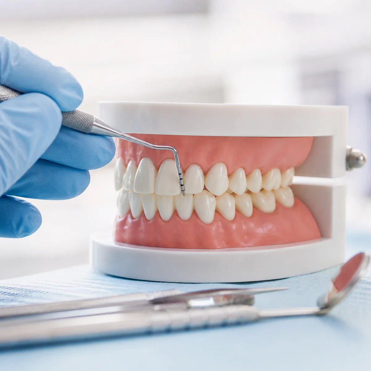 Tratamento de gengiva (Periodontia) na Dra. Greice Trevisani em São Bento do Sul